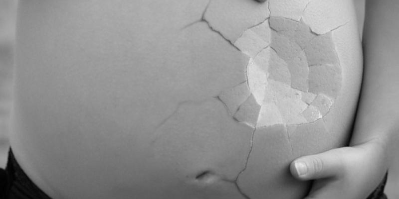 Imagen de una tripa de embarazada rota