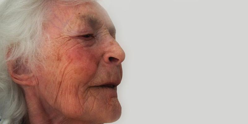 Mujer mayor con Alzhéimer