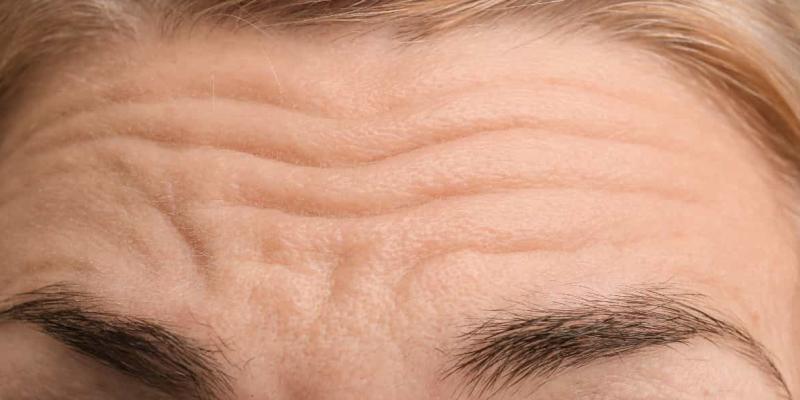 Cómo prevenir las arrugas