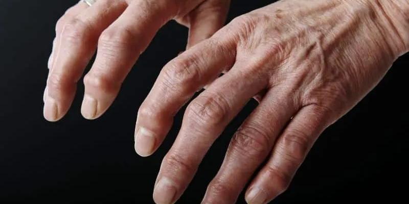 Manos de una persona mayor