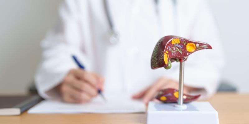 Médico con modelo de un cáncer de hígado