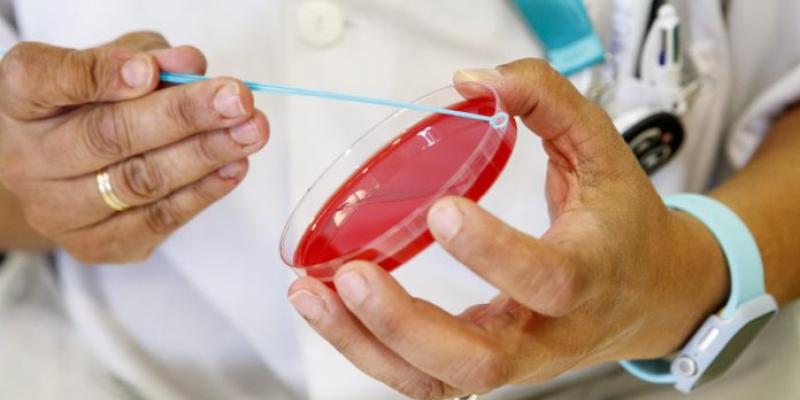 Aumentan los casos de sífilis