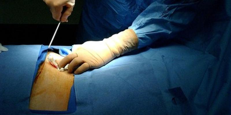 Imagen de Cirugía, Operación y Hospital. De uso gratuito.