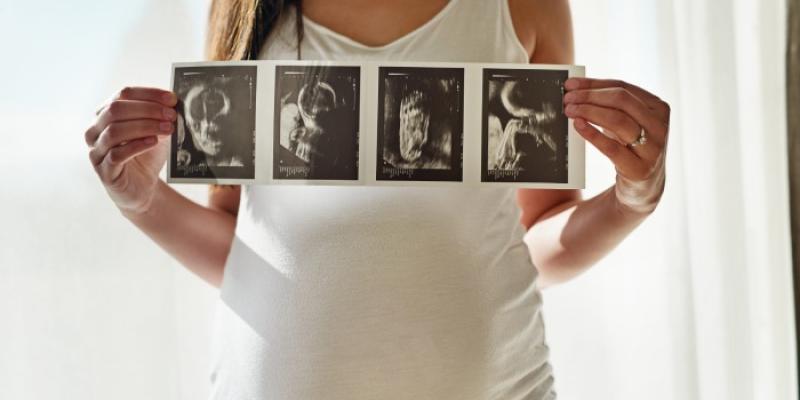 Una mujer embarazada muestra fotos de una ecografía del bebé