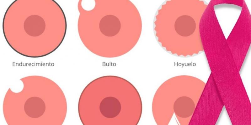 Síntomas cáncer de mama