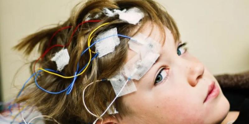 Prueba de encefalograma para detección de epilepsia