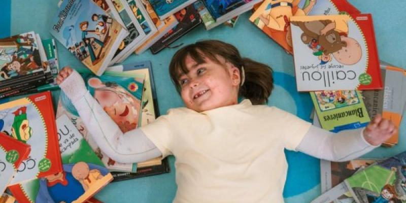 Paciente infantil con Piel de Mariposa