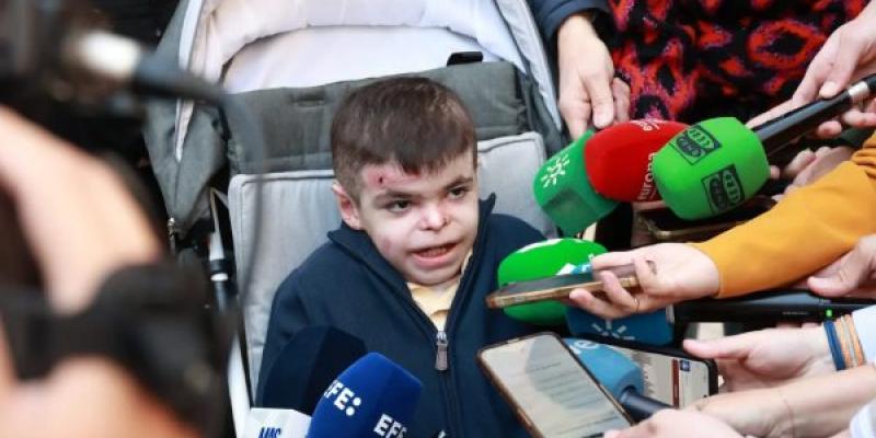 Leo García, el niño de 12 años andaluz que tiene piel de mariposa