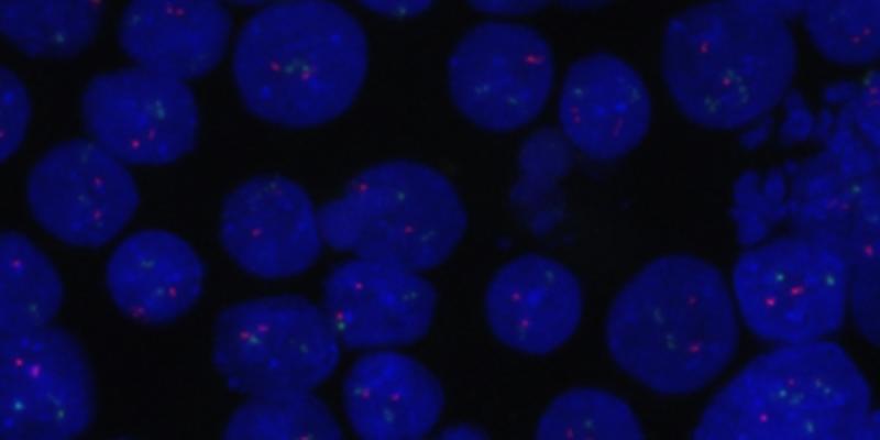 Células de linfoma de células del manto modificadas genéticamente