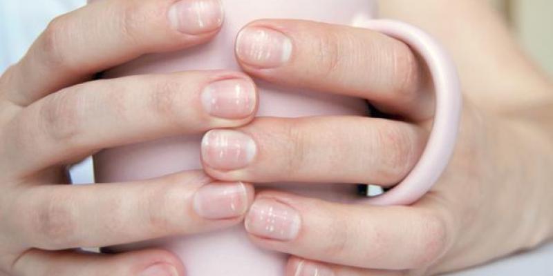 Por qué salen las manchas blancas en las uñas
