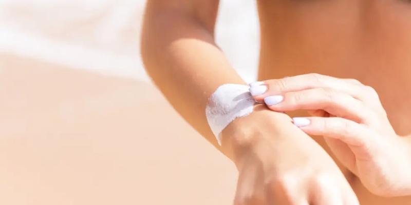 Las quemaduras solares son el principal factor de riesgo modificable en el melanoma.