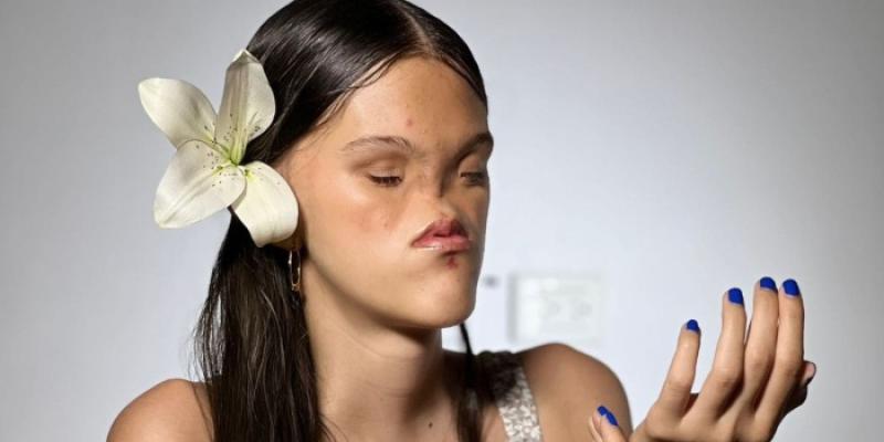 Nicole Monsalve, una artista con síndrome de Bosma.