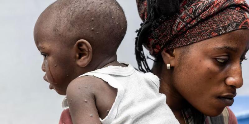 Una madre junto a su hijo en un hospital de República Democrática del Congo. 