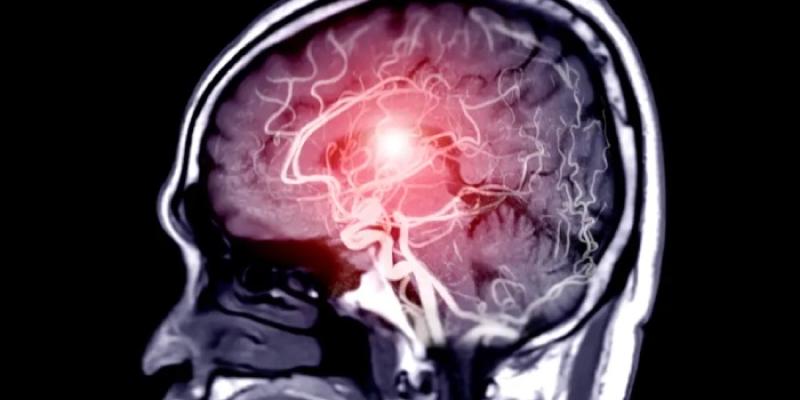 Una resonancia magnética de un cerebro humano.