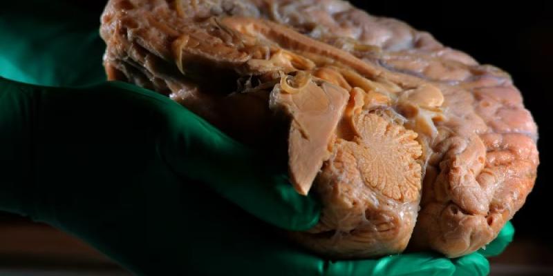 Imagen de un cerebro - Un pequeño circuito en la parte profunda del cerebro está detrás del bloqueo por estrés. 