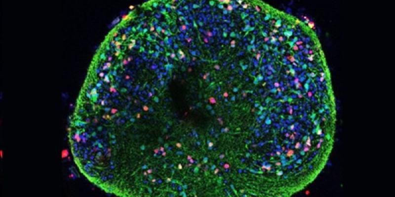 Modelo en 3D para reproducir mejor las condiciones del tejido cerebral