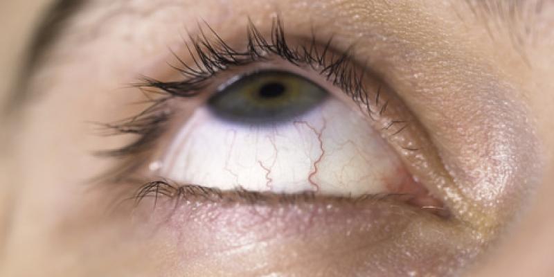 Consejos para la sequedad ocular