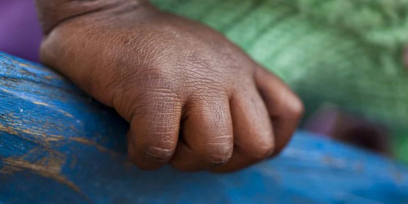 Pobreza infantil en Uruguay