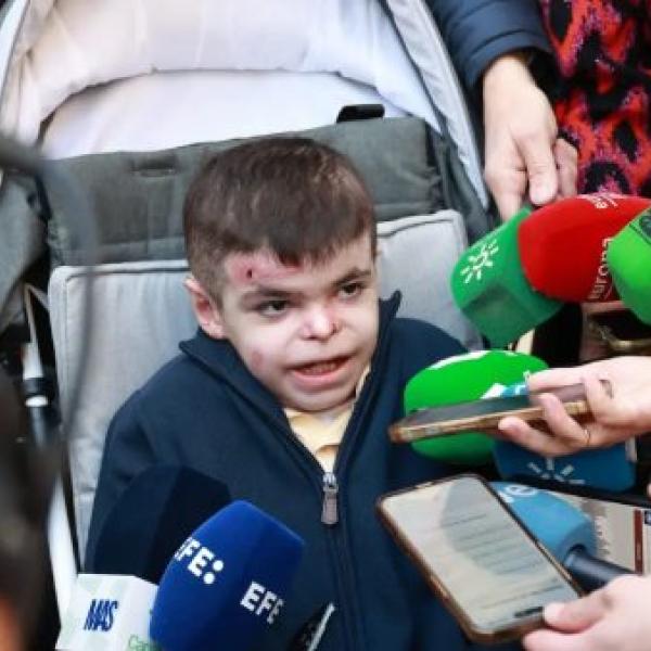 Leo García, el niño de 12 años andaluz que tiene piel de mariposa