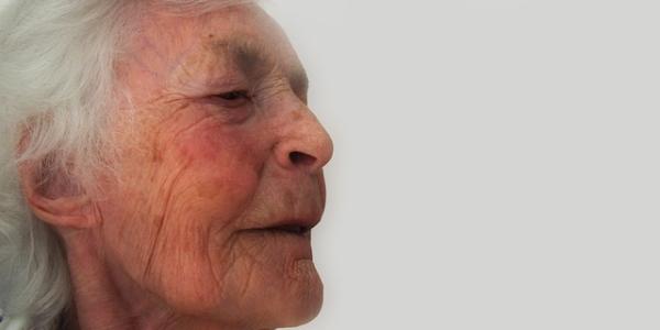 Mujer mayor con Alzhéimer