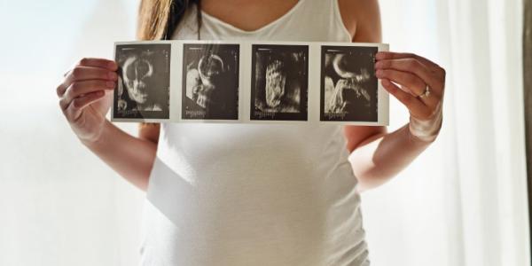 Una mujer embarazada muestra fotos de una ecografía del bebé