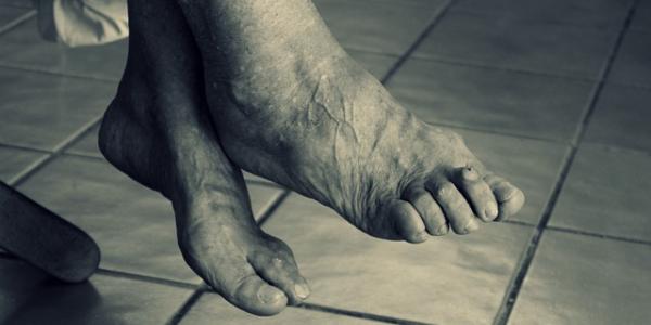 Pies de una persona mayor
