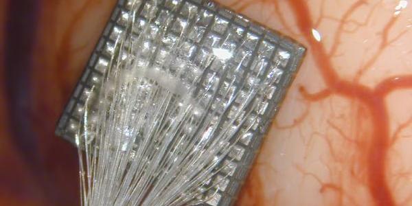 El implante cerebral de 2 mm en la corteza visual