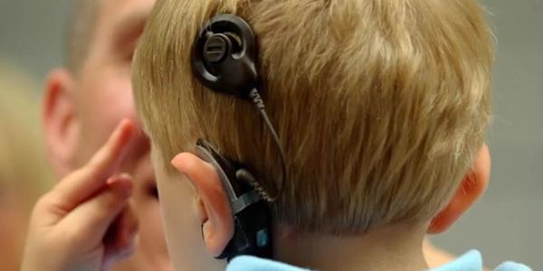 Falta de información en implantes cocleares