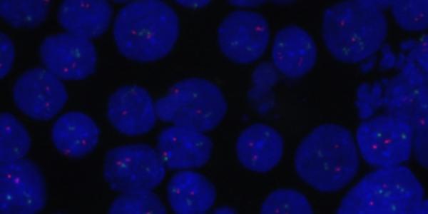 Células de linfoma de células del manto modificadas genéticamente