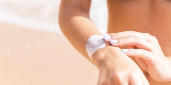 Las quemaduras solares son el principal factor de riesgo modificable en el melanoma.