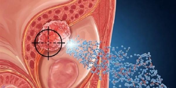 Detalle de la ilustración generada por IA que representa cómo actúan las micelas para liberar el fármaco 