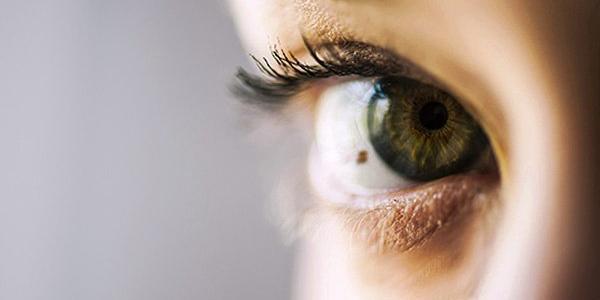 Nevus oculares o lunares en los ojos