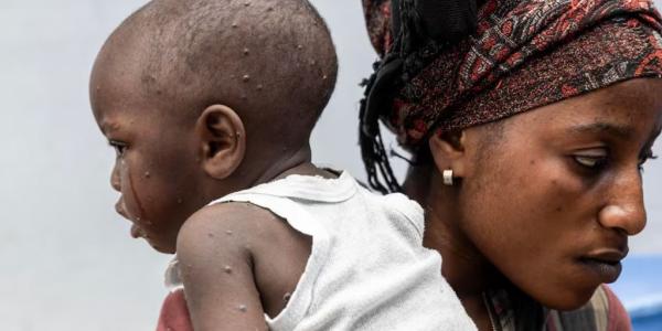 Una madre junto a su hijo en un hospital de República Democrática del Congo. 
