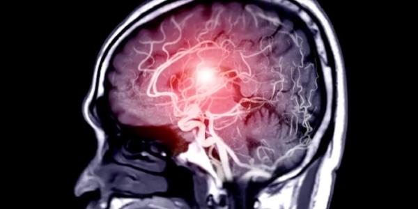 Una resonancia magnética de un cerebro humano.