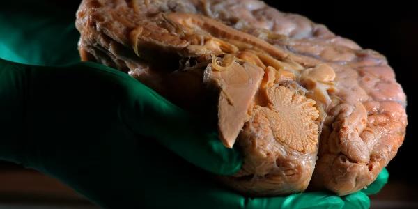 Imagen de un cerebro - Un pequeño circuito en la parte profunda del cerebro está detrás del bloqueo por estrés. 