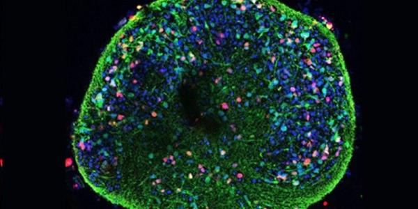 Modelo en 3D para reproducir mejor las condiciones del tejido cerebral