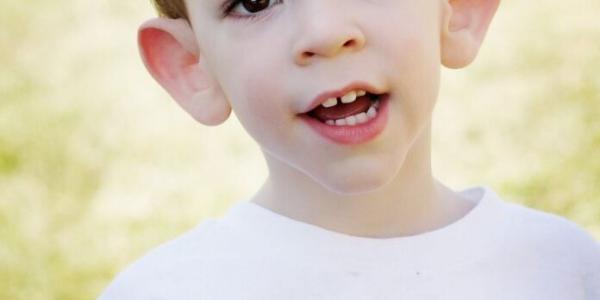 Niño con el Síndrome de X Frágil