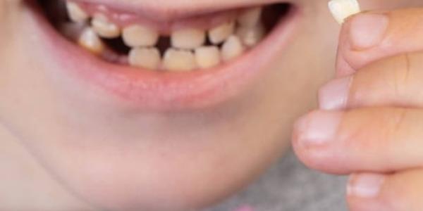 Sermade renueva su programa para mejorar la salud bucodental en personas con TEA