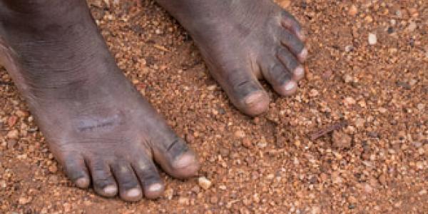 Tigray sufre consecuencias graves