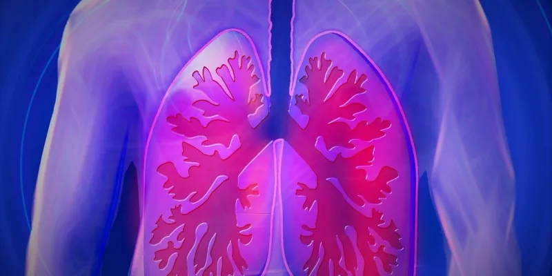 Enfermedad pulmonar vapeo