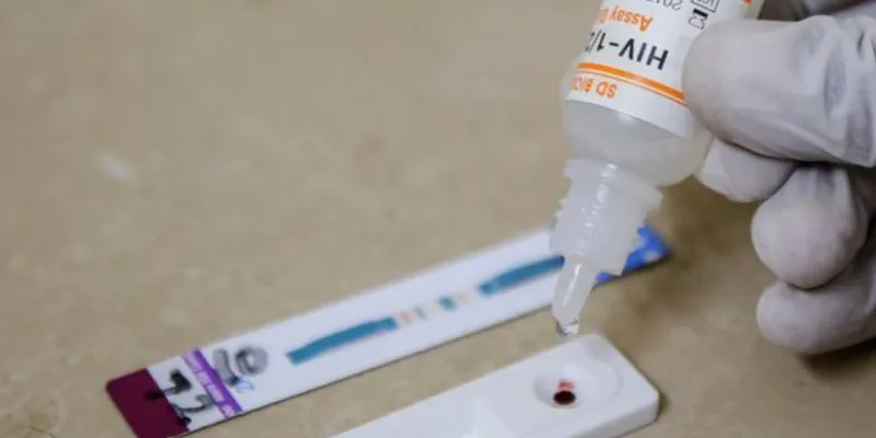 Un técnico de laboratorio realiza una prueba de detección del VIH en un centro médico de Hayatabad, en el distrito de Peshawar (Pakistán).