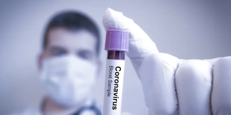Año perdido por la crisis del coronavirus