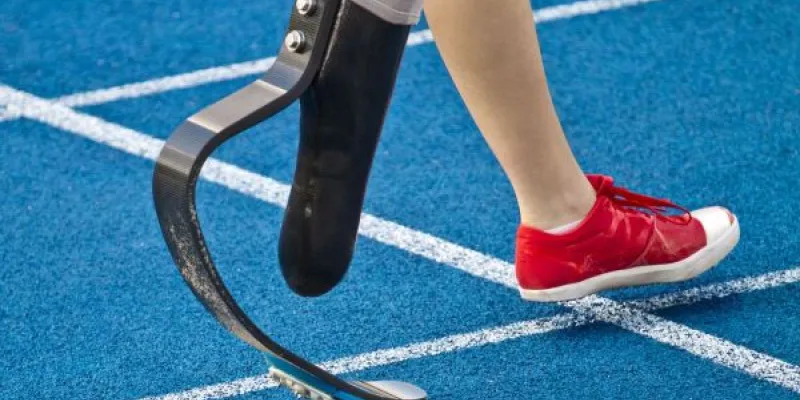 Una atleta adolescente con su prótesis adaptada para correr