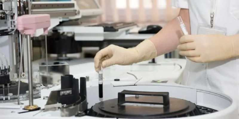 Conocemos las bacterias que eliminan el ibuprofeno de las aguas residuales