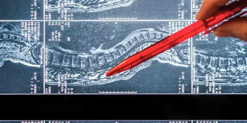 Una neurocirujana señala la zona del daño medular 