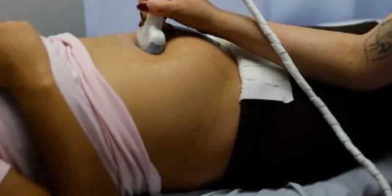 Una mujer embarazada se realiza un ultrasonido en un centro hospitalario. 