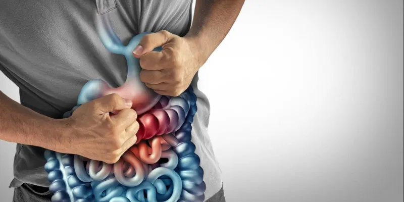 Avances en la Enfermedad de Crohn