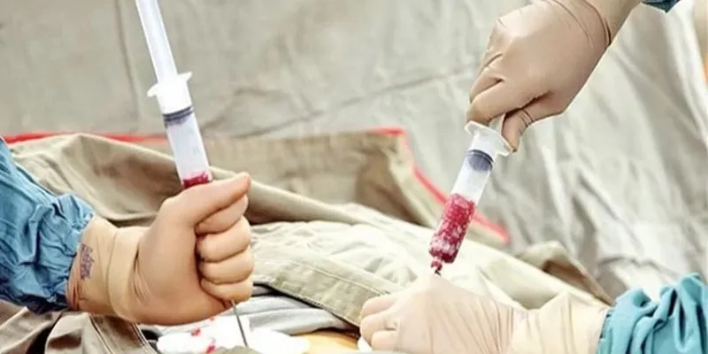 La donación de médula ósea sigue enfrentando un desafío clave