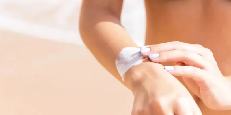 Las quemaduras solares son el principal factor de riesgo modificable en el melanoma.
