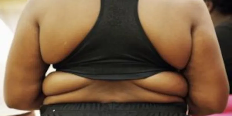obesidad en África